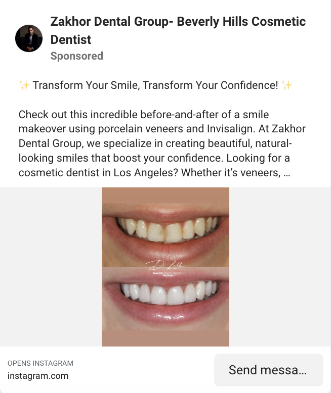 Before-and-After Transformations